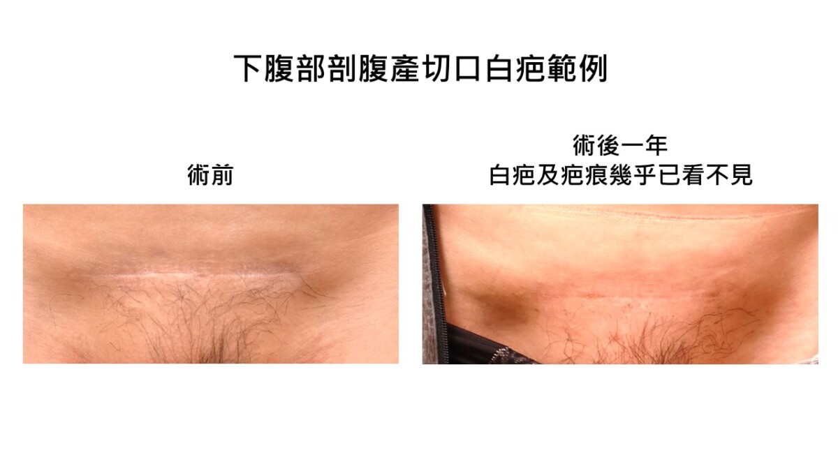 2ea156e228b623d703d8c271027472d4