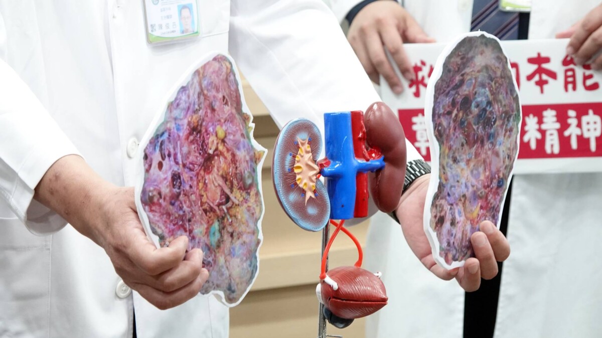 599f7f0388b977a4882b0f0befcf2dbe