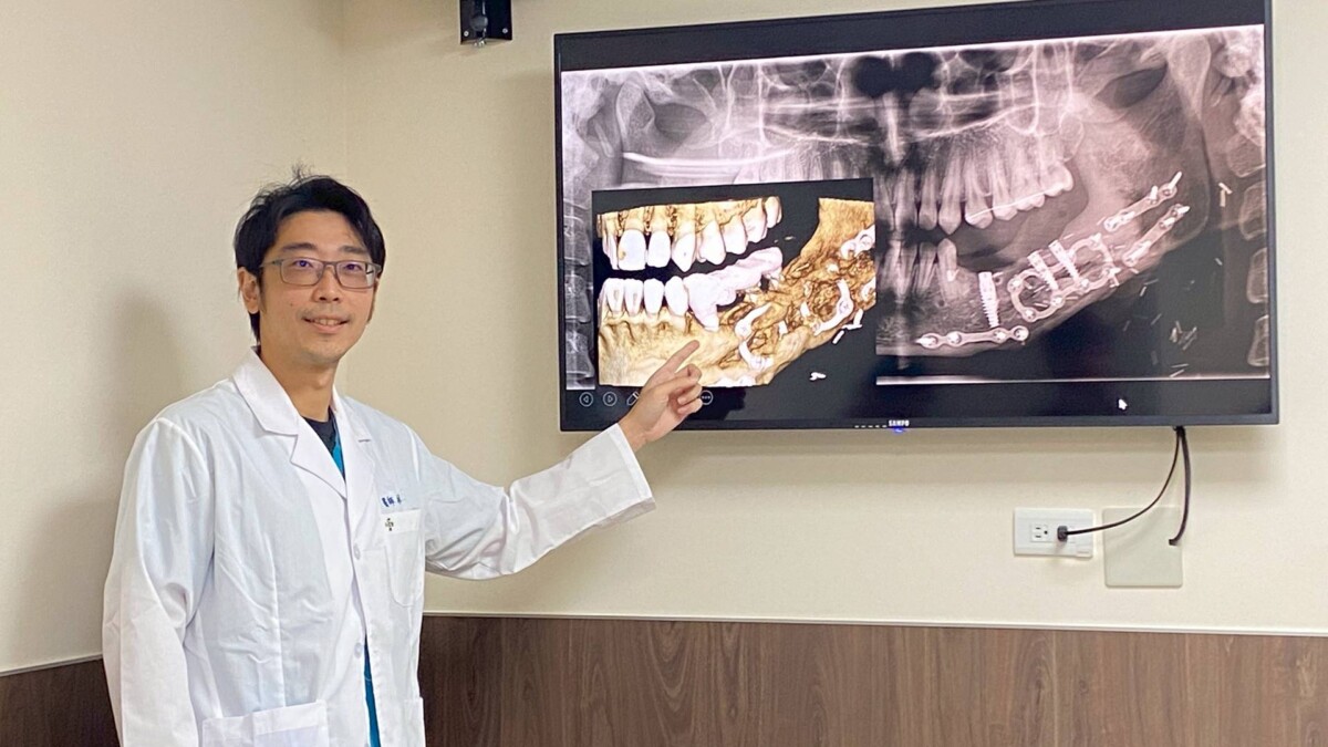 18歲少女罹患罕見顎骨腫瘤 彰化秀傳3D列印重建手術助重拾笑容 86204c30296314eab16c9d21035fb50f