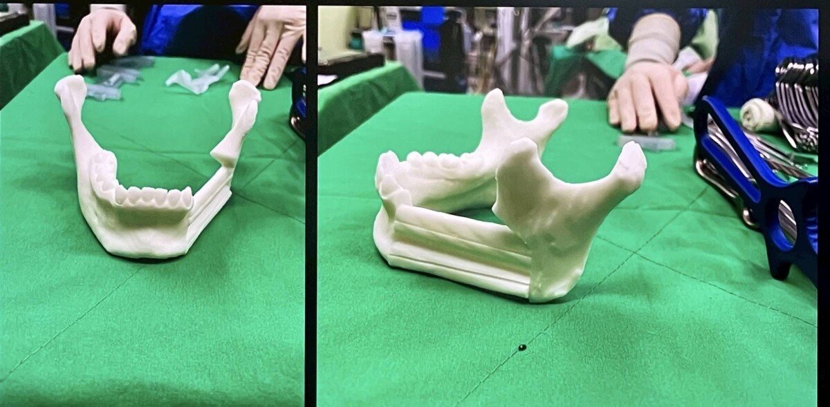 F95f57c177e18a4349b6bc50452841a8