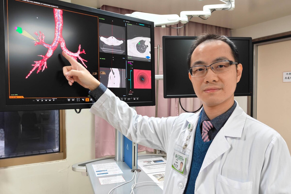 肺癌診斷、手術同日完成　彰基一站式微創治療更精準3